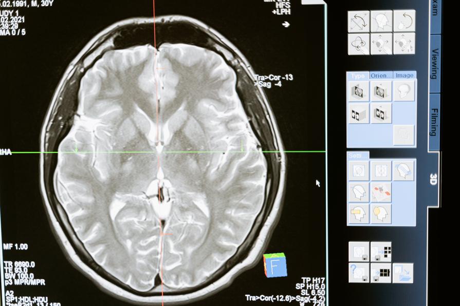 Mycelium and its role in brain health